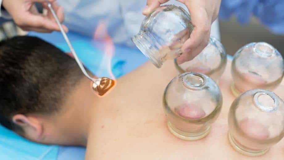 Puur Cupping - Cupping